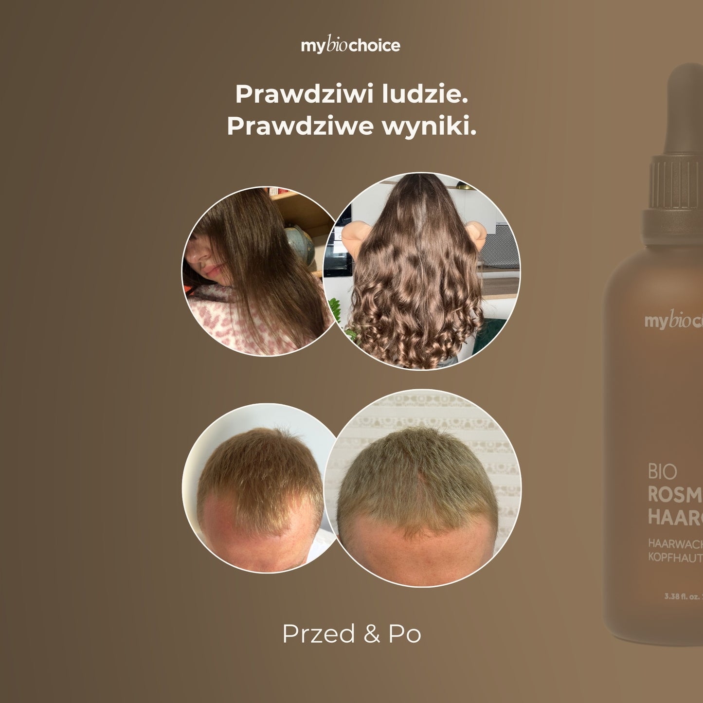 Efekty przed i po użyciu olejku rozmarynowego mybiochoice – poprawa gęstości i kondycji włosów.