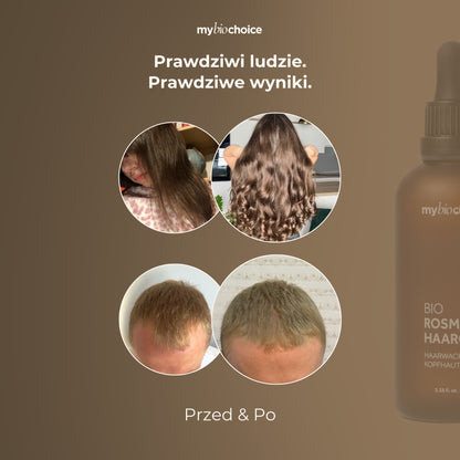 Efekty przed i po użyciu olejku rozmarynowego mybiochoice – poprawa gęstości i kondycji włosów.